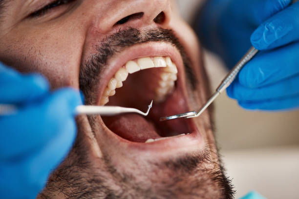 Best Knocked-Out Tooth Emergency  in Hendersonville, TN
